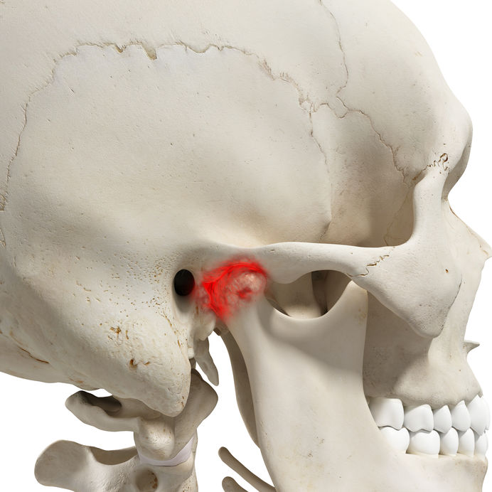 TMJ Therapy Hong Kong