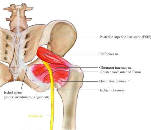 Sciatica Treatment Hong Kong Sciatica Treatment Hong Kong